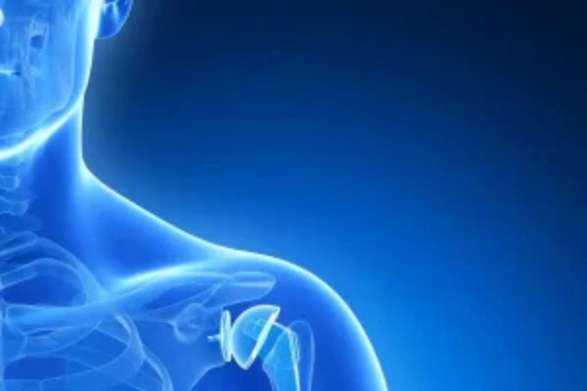 Shoulder Replacement Surgery