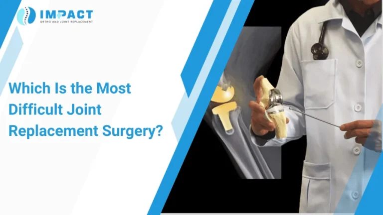 Joint Replacement Surgery