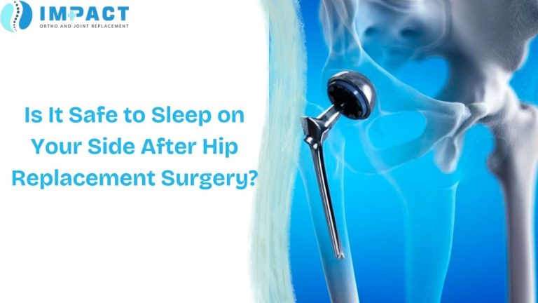 Is It Safe to Sleep on Your Side After Hip Replacement Surgery
