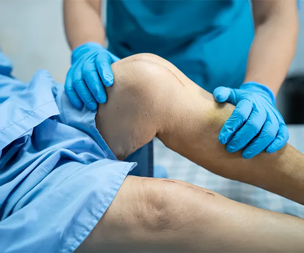 Advanced Knee Replacement Technology in India