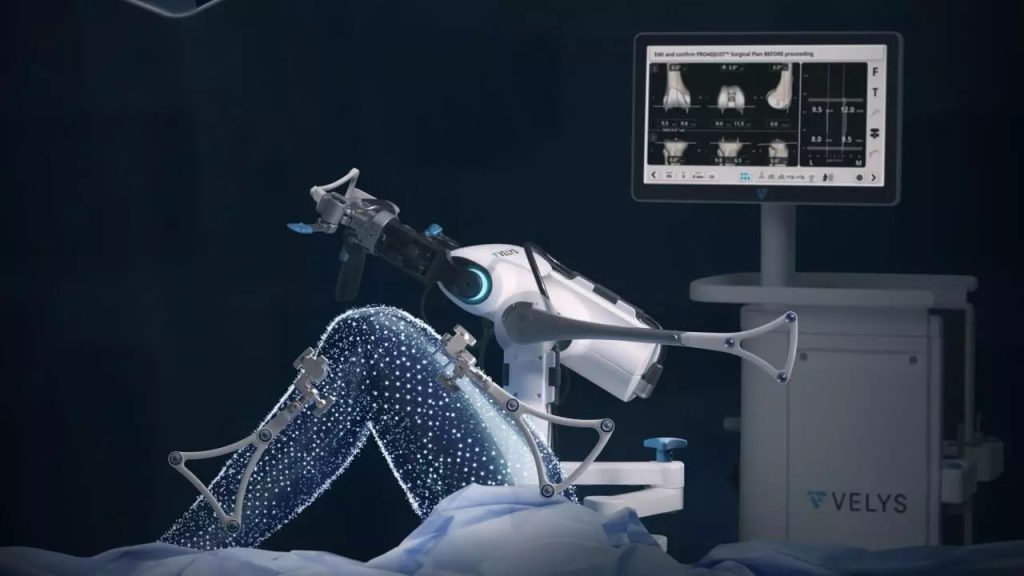 velys robo knee machine