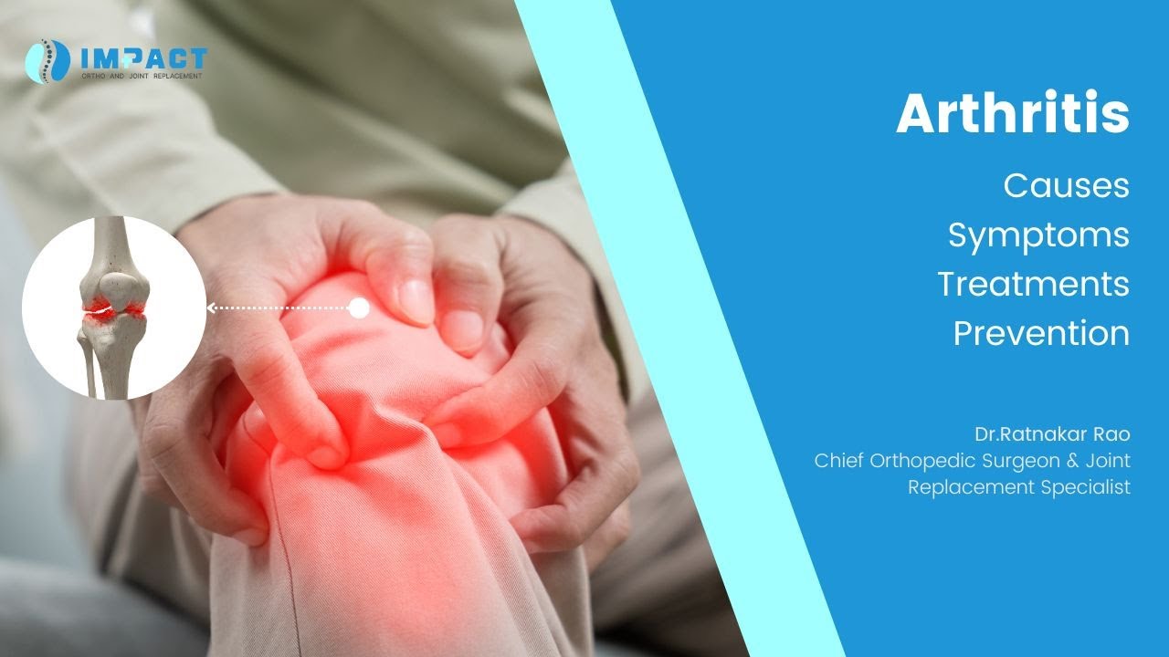 Everything you need to know about Arthritis  by Dr. Ratnakar Rao